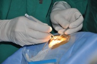 Tin mới y tế ngày 5/4: Giác mạc sinh học thắp lại thị lực cho hàng trăm nghìn người