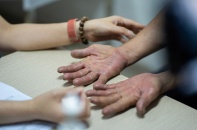 Bệnh da liễu bùng phát trong mùa nắng nóng, bác sỹ khuyến cáo cách phòng bệnh