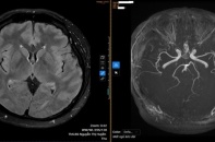 Mất ngủ kéo dài vì áp lực công việc, người đàn ông 36 tuổi đối mặt nhiều nguy cơ sức khỏe