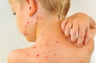 Đề xuất xử phạt nghiêm trường hợp thông tin chữa bệnh chưa kiểm chứng