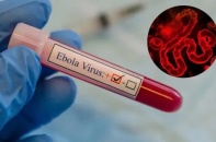 Tin mới y tế ngày 22/5: Việt Nam tăng cường giám sát Ebola tại cửa khẩu
