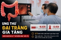 Tin mới y tế ngày 26/7: Ung thư đại trực tràng gia tăng, nhiều bệnh nhân lỡ "thời điểm vàng" điều trị