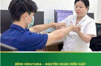 Tin mới y tế ngày 1/8: Phát hiện mắc bệnh Hirayama hiếm gặp qua biểu hiện yếu tay