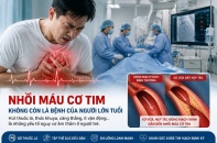 Tin mới y tế ngày 12/8: 30 tuổi đã nhồi máu cơ tim, cảnh báo bệnh tim ngày càng trẻ hóa