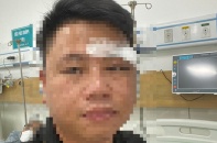 Đà Nẵng: Một luật sư bị 4 đối tượng lạ mặt hành hung, nhập viện