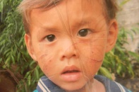 Phẫn nộ với "ma nữ" nhiều năm rạch nát mặt trẻ con