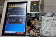 Cháu bé bị bố đánh dã man bằng điếu cày đã tử vong