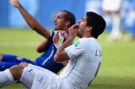 Kỳ quặc: Hàng chục cổ đông viên đã cá cược Suarez sẽ cắn đối thủ