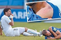 Truyền thông Italy gọi Suarez là "quỷ hút máu người" Dracula