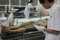 20 nạn nhân vụ tai nạn xe khách ở Lào Cai ra viện