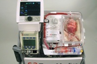 Bác sỹ Australia cấy ghép thành công tim đã ngừng đập cho bệnh nhân
