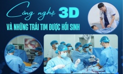  [Emagazine] Công nghệ 3D và những trái tim được hồi sinh