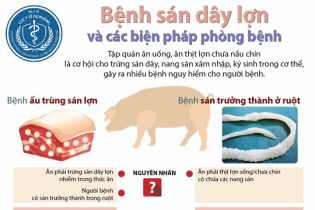 [Infographic] Bệnh sán dây lợn và các biện pháp phòng bệnh