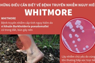 Bộ Y tế yêu cầu tăng cường phối hợp chẩn đoán, điều trị bệnh Whitmore