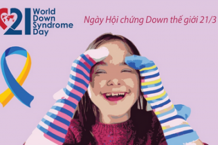 Ngày Hội chứng Down thế giới 21/3: Những điều cần biết