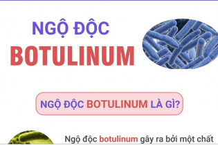 Ngộ độc Botulinum là gì?