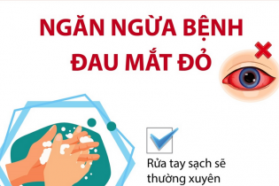 Ngăn ngừa bệnh đau mắt đỏ