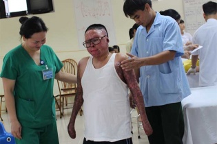 Cảm phục nghị lực phi thường của người lính sống sót sau vụ máy bay rơi
