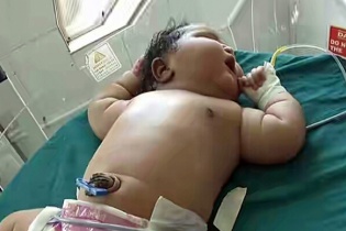 Bà mẹ Ấn Độ sinh con nặng gấp đôi trọng lượng bé sơ sinh bình thường