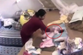 Vụ nữ giúp việc tung hứng, đánh trẻ dã man: Bác sĩ nói gì?