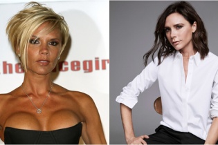 Victoria Beckham cùng 9 sao nữ thú nhận hối hận vì đã phẫu thuật thẩm mỹ