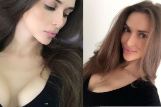 Mỹ nhân mang "cặp tuyết lê" hình vuông vì... phẫu thuật thẩm mỹ