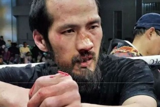 Bại tướng của Từ Hiểu Đông nói gì sau khi bị đấm vỡ mũi?