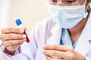 Hà Nội gia tăng trẻ mắc thủy đậu