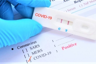 Cấp mã số ca bệnh cho người có kết quả dương tính qua test nhanh thế nào