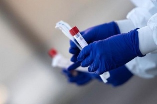 Vì sao lại có nhiều mức giá test nhanh Covid-19?