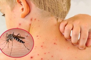 Ứng phó với sốt xuất huyết tại các "điểm nóng"