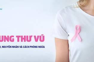 Trên 70% ca ung thư vú được phát hiện và điều trị sớm