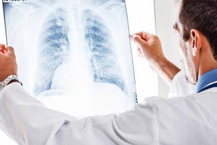 Tin mới về y tế ngày 20/12: Thành lập Chương trình bệnh phổi kẽ; Hà Nội thời tiết lạnh, nhưng vẫn hơn 1.100 ca sốt xuất huyết mắc mới