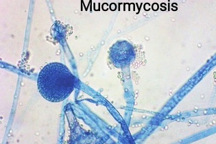 Tin mới về y tế ngày 12/3: Gia tăng các bệnh nhiễm trùng khó điều trị sau Covid-19; Tăng cường công tác kiểm dịch y tế biên giới