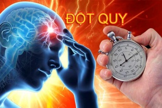 Tin mới về y tế ngày 10/7: Nguy kịch do chữa đột quỵ theo cách truyền miệng