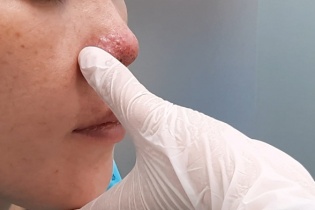 Trả giá vì tin lời quảng cáo làm đẹp "siêu nhanh, siêu rẻ"