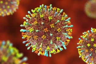 Tin mới về y tế ngày 29/9: Giám sát chặt virus Nipah