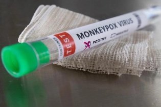 Kiểm soát sự lây lan của dịch đậu mùa khỉ