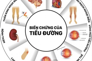 Nguy hiểm khi không tuân thủ điều trị tiểu đường