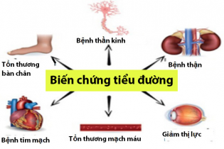Tăng cao bệnh nhân bị biến chứng đái tháo đường