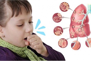 Bác sĩ khuyến cáo gì khi dịch ho gà đang tăng mạnh?