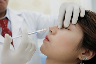 Lạm dụng tiêm filler làm đẹp, hậu quả thế nào?