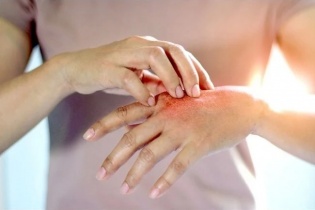 Sai lầm điều trị bệnh lý về da