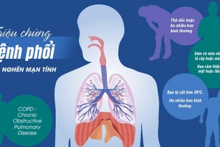 Nguy cơ mắc bệnh phổi tắc nghẽn mạn tính vì thuốc lá