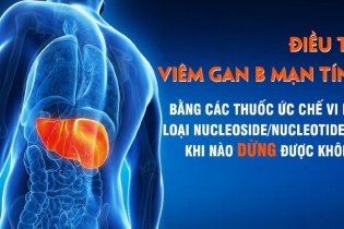 Có nên dừng điều trị khi mắc viêm gan B mạn tính?
