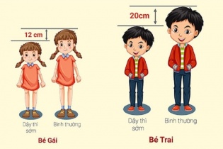 Cha mẹ cần chú ý dấu hiệu dậy thì sớm ở trẻ