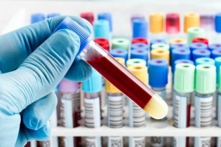 Nhiễm khuẩn huyết từ thói quen không ngờ