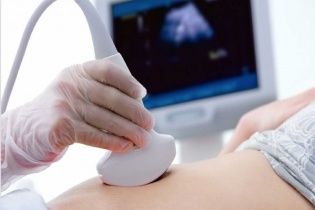 Sàng lọc trước sinh vì chất lượng dân số Việt