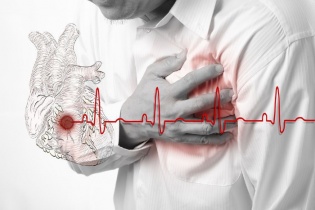 Phân biệt say rượu và đột quỵ