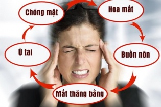 Nhiều người trẻ mắc rối loạn tiền đình